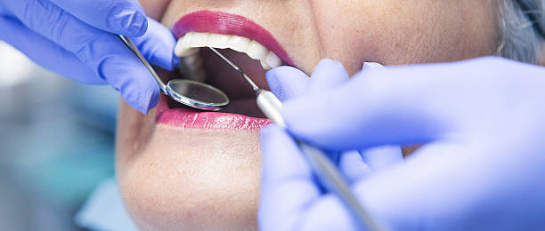 Best Emergency Treatment for Dental Infections or Abscesses in Auburn, NY